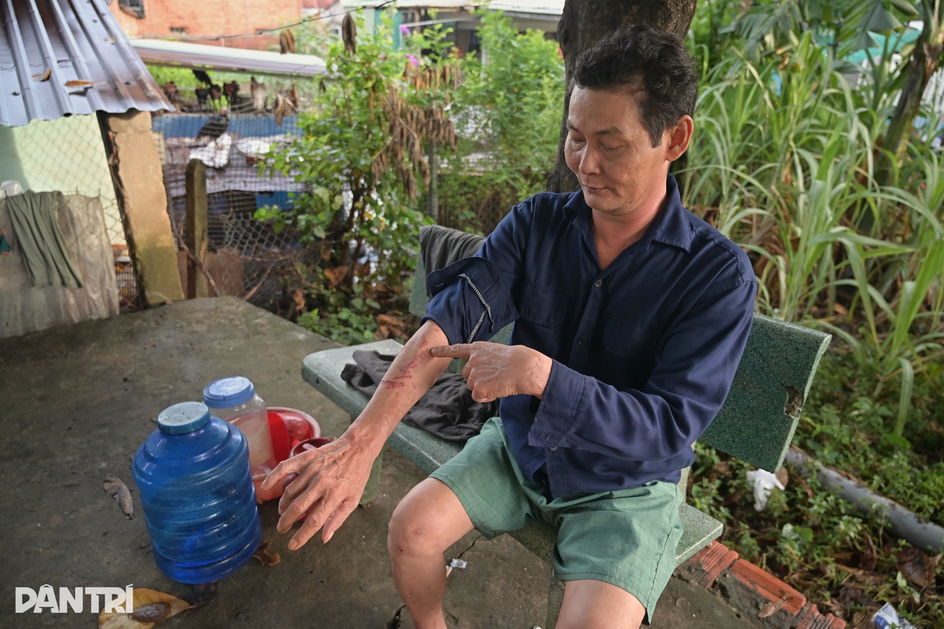 Mưa lớn sập tường, người đàn ông thoát chết trong gang tấc ở TPHCM - 2 Mưa lớn sập tường, người đàn ông thoát chết trong gang tấc ở TPHCM - 2