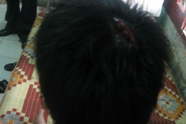 Gần 100 côn đồ xông vào trường cao đẳng tấn công sinh viên