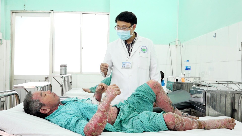 Lột da toàn thân như rắn vì tự ý dùng thuốc - 3 Lột da toàn thân như rắn vì tự ý dùng thuốc - 3