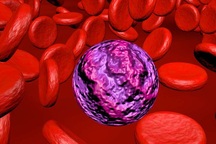 Ung thư máu và những phương pháp điều trị