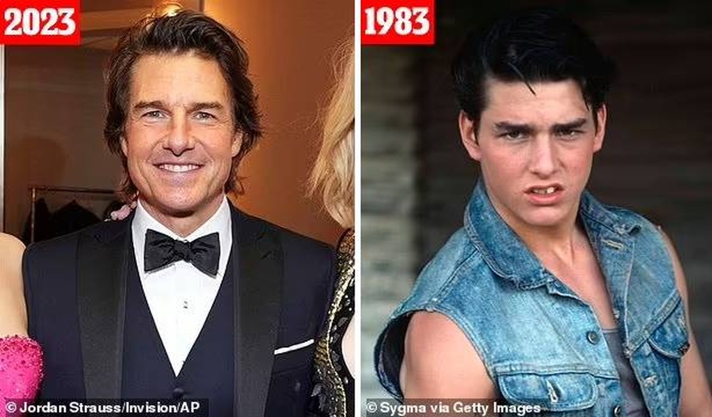 Tom Cruise không phải lúc nào cũng... cười đẹp như bây giờ - 1