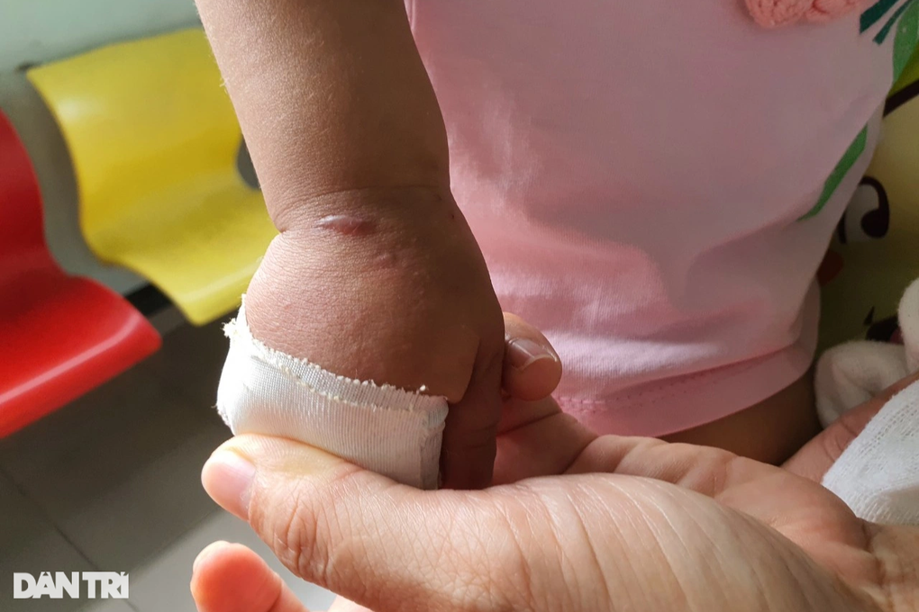 Tiếng khóc ngằn ngặt của bé mắc bệnh hiếm, khẩn cầu cơ hội được tái sinh - 3 Tiếng khóc ngằn ngặt của bé mắc bệnh hiếm, khẩn cầu cơ hội được tái sinh - 3