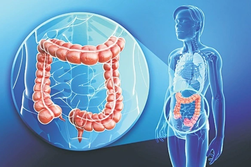 Ung thư đại trực tràng có chữa khỏi không? - 1 Ung thư đại trực tràng có chữa khỏi không? - 1