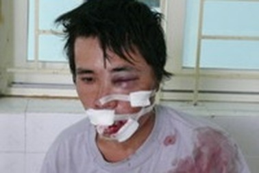 Trộm chó phải trả giá bằng nhiều mạng người