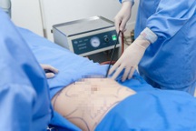 Một phụ nữ ở TPHCM tử vong sau khi hút mỡ bụng tại bệnh viện thẩm mỹ