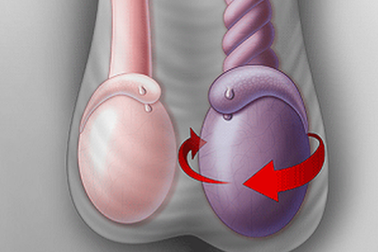 Giấu bố mẹ vì đau ở “vùng khó nói”, cậu học trò suýt bị cắt bỏ tinh hoàn