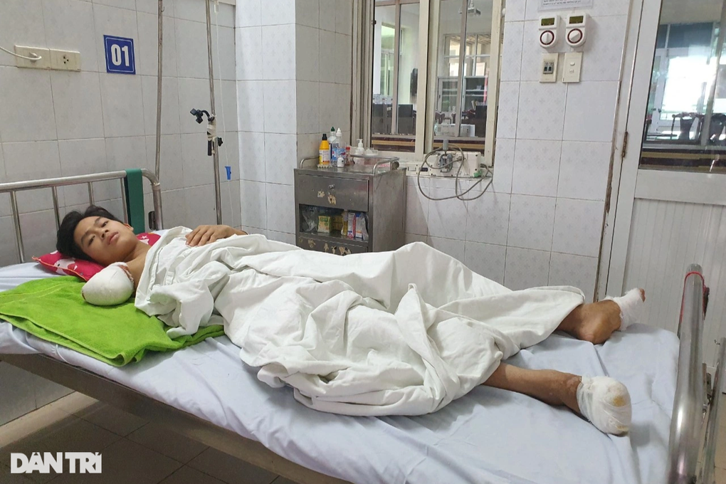 Bác sĩ kêu gọi giúp đỡ cậu bé 15 tuổi người Dao bị bỏng điện, mất tay phải - 2 Bác sĩ kêu gọi giúp đỡ cậu bé 15 tuổi người Dao bị bỏng điện, mất tay phải - 2