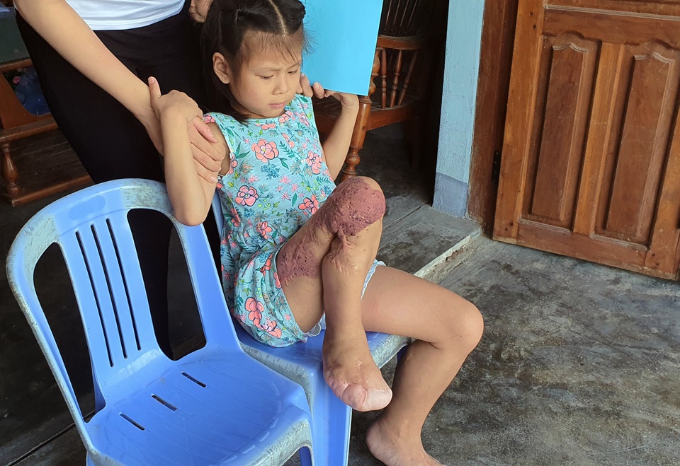 Bạn đọc Dân trí giúp đỡ bé gái hơn 130 triệu đồng tìm sự sống mong manh - 2 Bạn đọc Dân trí giúp đỡ bé gái hơn 130 triệu đồng tìm sự sống mong manh - 2