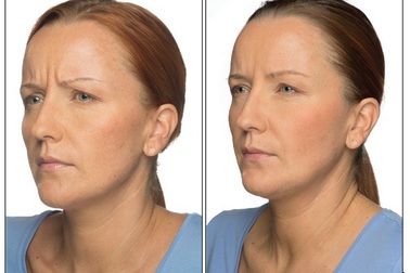 Trẻ hóa da đón Tết, chị em nhất định không được quên điều này…