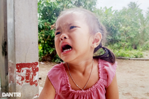 Người mẹ Khmer nghèo cầu xin cứu mạng sống con gái 4 tuổi bị u gan quái ác