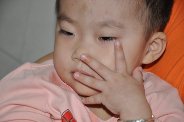 Sặc cháo, bé 3 tuổi bị tổn thương não trầm trọng