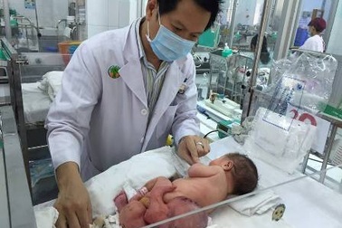 Bóc thành công u quái khổng lồ cho bé gái sơ sinh