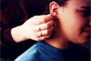 Bấm lỗ tai sớm để tránh sẹo lồi