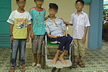 Bệnh Wilson: Nguy hiểm nhưng rất khó phát hiện 