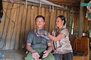 Cha ôm khối u to như quả bưởi, mong từng đồng công chăn trâu của con