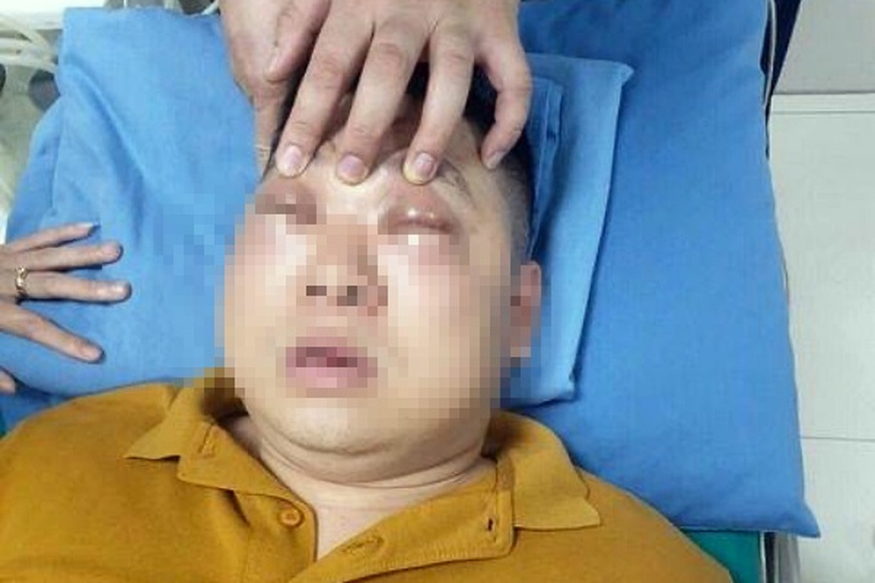 Nam thanh niên bị sốc phản vệ nặng chỉ vì thái củ hành - 1 Nam thanh niên bị sốc phản vệ nặng chỉ vì thái củ hành - 1