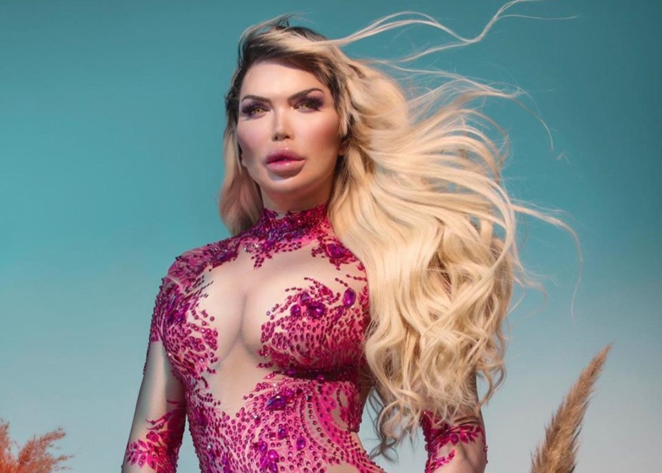 Sao chuyển giới Rodrigo Alves thấy gợi cảm hơn sau khi đại tu vòng ba - 7 Sao chuyển giới Rodrigo Alves thấy gợi cảm hơn sau khi đại tu vòng ba - 7
