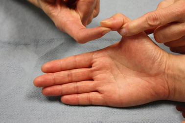 Đi khám vì đau khớp mới biết mắc bệnh lạ "ngón tay cò súng"