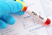 Chỉ số PSA và những cảnh báo nguy cơ ung thư tiền liệt tuyến