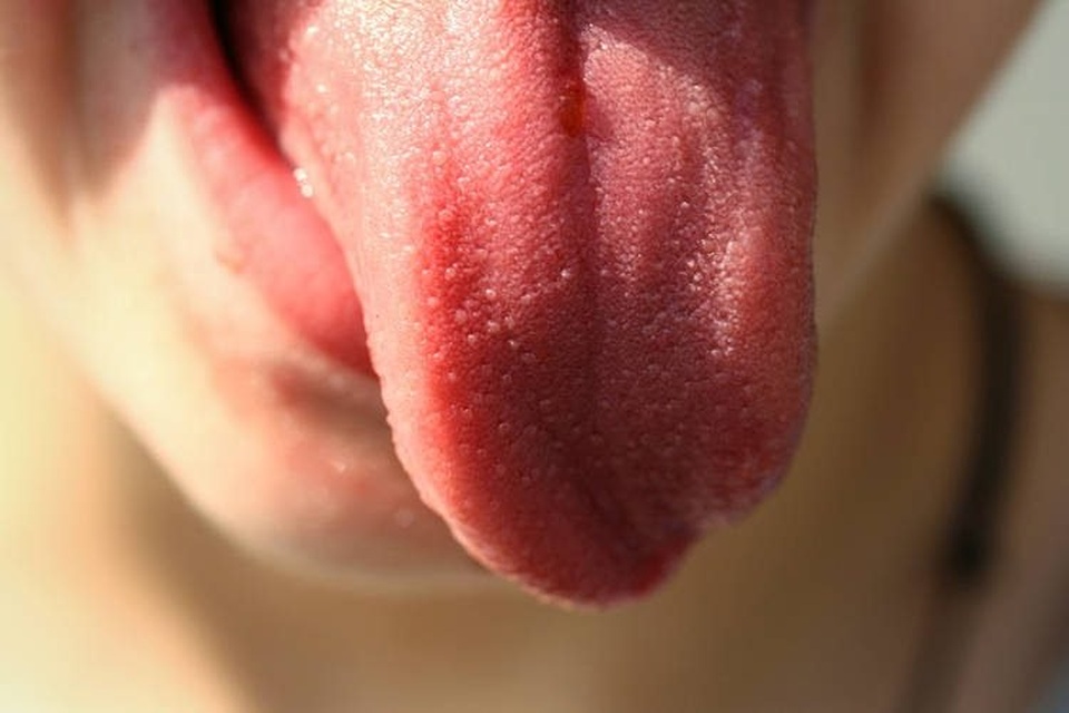 Tự cắt lưỡi để không bị lây virus corona - 1 Tự cắt lưỡi để không bị lây virus corona - 1