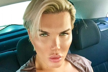 "Búp bê sống" Rodrigo Alves phẫu thuật mũi lần thứ 10