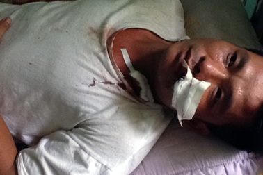 Nhóm côn đồ truy sát cả nhà trong đêm tối