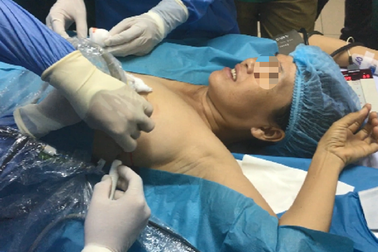 Khám tầm soát miễn phí ung thư tuyến vú