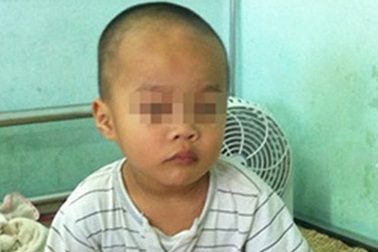 Cấp cứu kịp thời bé trai 3 tuổi bị xoắn tinh hoàn