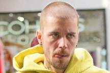 Tình trạng sức khỏe tinh thần của Justin Bieber khiến người hâm mộ lo lắng