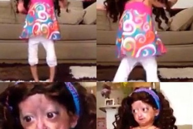 Bé 6 tuổi có thân hình bà lão