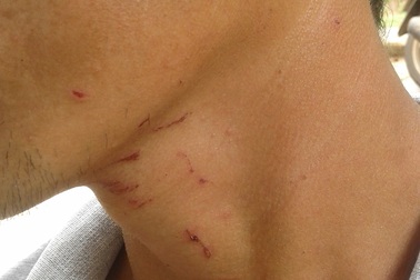 Dân tố công an xã đánh người, nổ súng