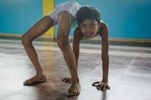 Cậu bé “người rắn” với khả năng uốn dẻo kinh ngạc