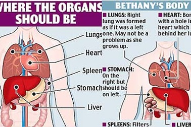 Sống khỏe với 5 lá lách và 1 lá gan hỏng...
