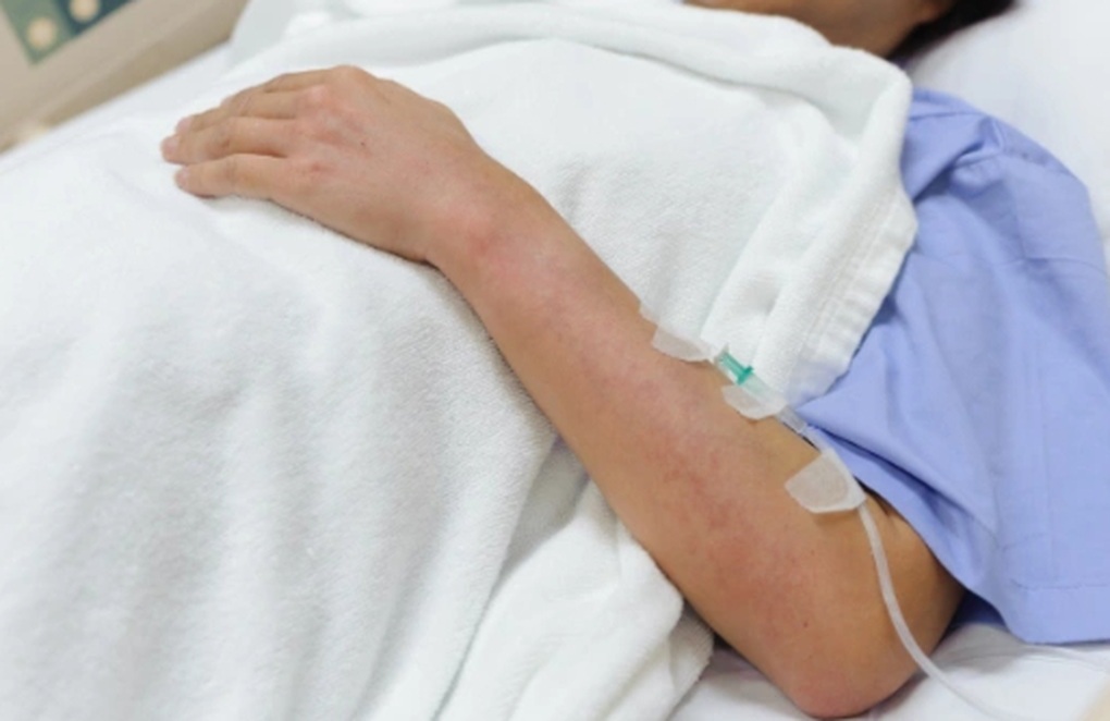 Sốt xuất huyết Dengue gây tổn thương gan: Những điều bạn cần biết - 1 Sốt xuất huyết Dengue gây tổn thương gan: Những điều bạn cần biết - 1