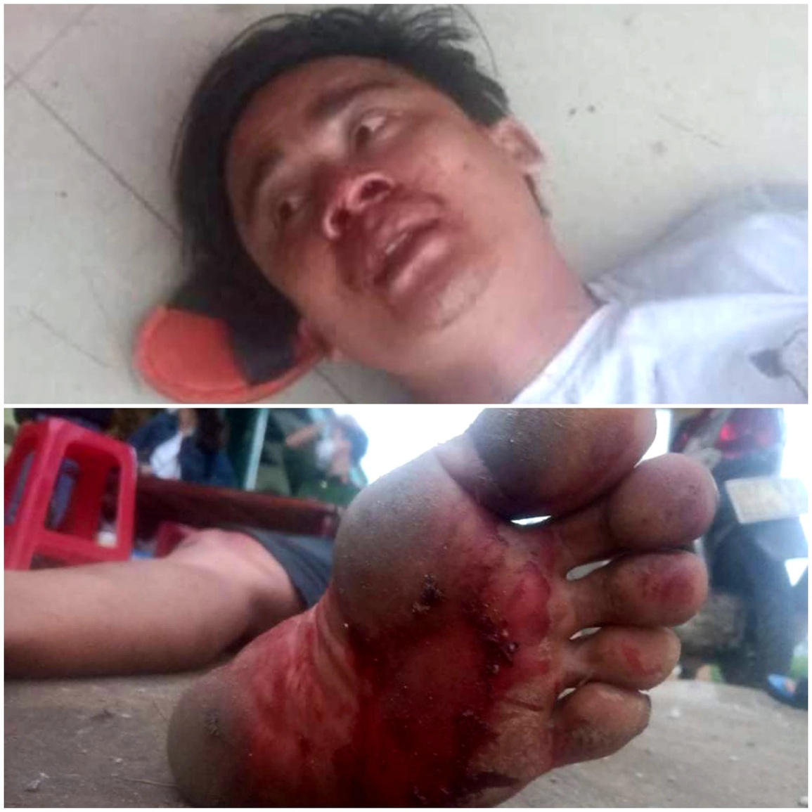 Đi nhận lương, công nhân bị giám đốc đánh gãy tay, gãy mũi - 1 Đi nhận lương, công nhân bị giám đốc đánh gãy tay, gãy mũi - 1