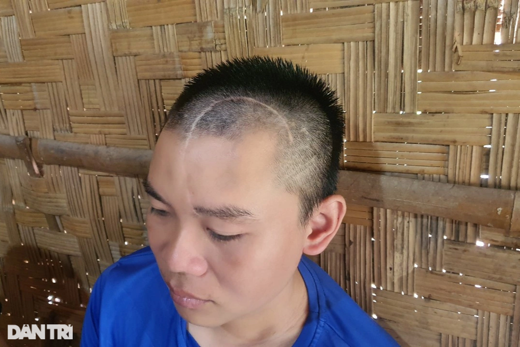 Cha gặp nạn chấn thương sọ não, 2 con thơ gập ghềnh đường đến trường - 2 Cha gặp nạn chấn thương sọ não, 2 con thơ gập ghềnh đường đến trường - 2