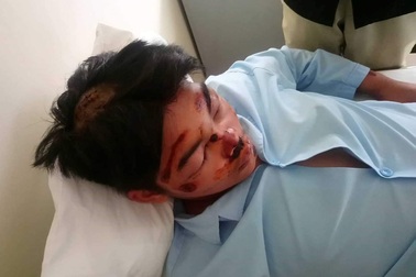 Sau khi được gọi ra trường “nói chuyện”, nam sinh lớp 11 bị chém nhập viện