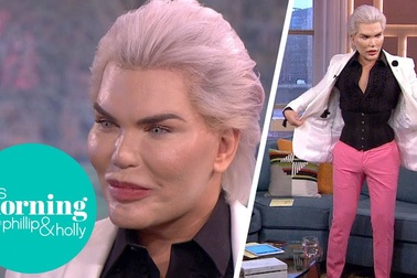 Rodrigo Alves chia sẻ về ca phẫu thuật cắt xương sườn