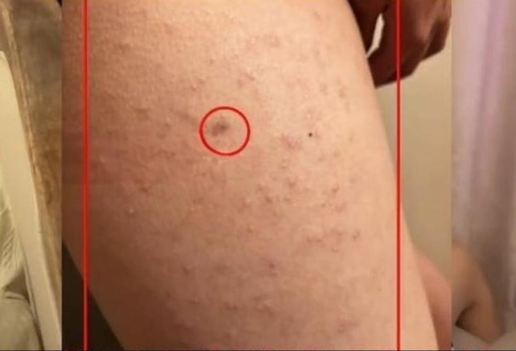 Chinees meisje wordt ervan verdacht honderden keren in haar been te zijn gestoken door een klasgenoot met een naai-priem - 2 Bé gái Trung Quốc nghi bị bạn học dùng dùi khâu đâm vào chân cả trăm nhát - 2