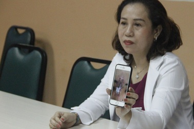 Nữ sinh viên 19 tuổi hoại tử mũi vì tiêm chất làm đầy