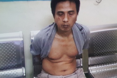 Hiệp sĩ phải điều trị phơi nhiễm HIV sau khi bắt cướp