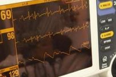 Thế giới đã có máy điều hòa tim Wi-fi