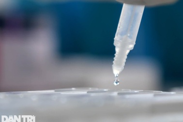 Nguy cơ viêm gan cấp tính nặng ở trẻ mắc Covid-19