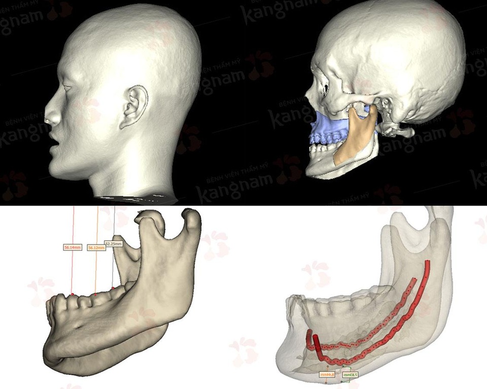 Giải pháp thiết kế khuôn mặt 3D sẽ thay đổi ngành thẩm mỹ như thế nào? - 1 Giải pháp thiết kế khuôn mặt 3D sẽ thay đổi ngành thẩm mỹ như thế nào? - 1