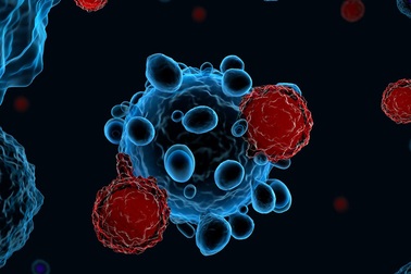 Ứng dụng AI trong chẩn đoán ung thư buồng trứng