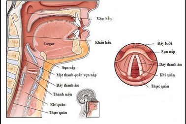 Tại sao khản tiếng kéo dài dễ dẫn đến ung thư thanh quản?