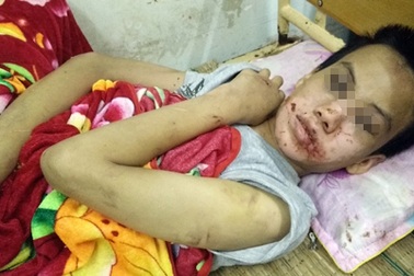 Cháu trai 14 tuổi câm điếc bị xâm hại thương tâm trong khách sạn