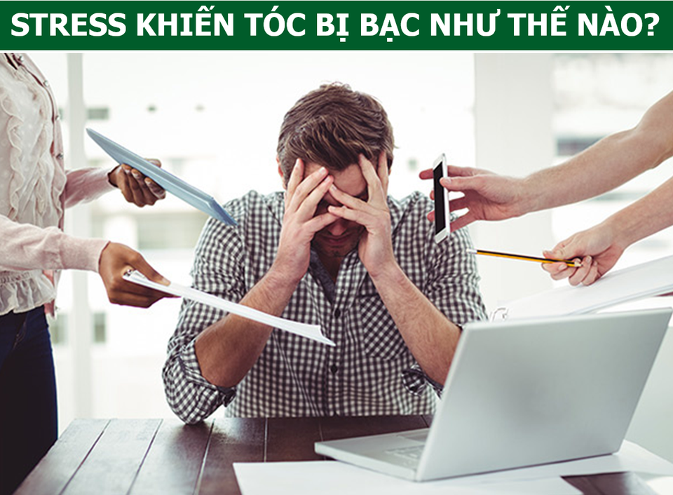 Bạc tóc vì căng thẳng, buồn phiền là hoàn toàn có thật - 1 Bạc tóc vì căng thẳng, buồn phiền là hoàn toàn có thật - 1