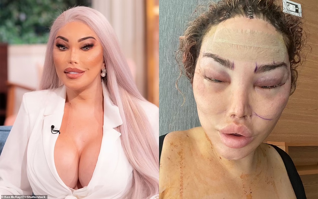 Sao chuyển giới Jessica Alves lộ diện sau ca thẩm mỹ lần thứ 90 - 1 Sao chuyển giới Jessica Alves lộ diện sau ca thẩm mỹ lần thứ 90 - 1