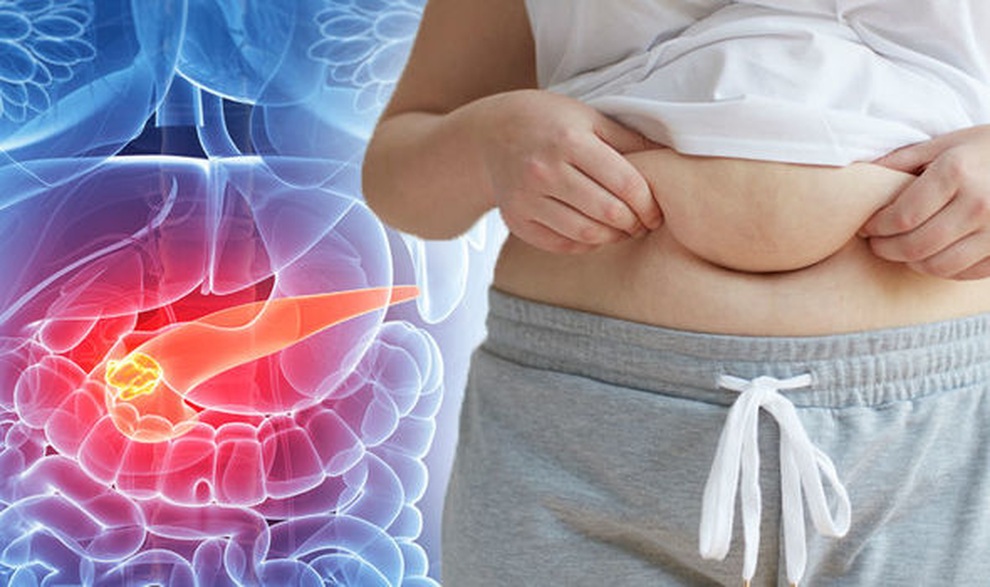 Có những biểu hiện này, ung thư tụy đã ở giai đoạn cuối - 1 Có những biểu hiện này, ung thư tụy đã ở giai đoạn cuối - 1